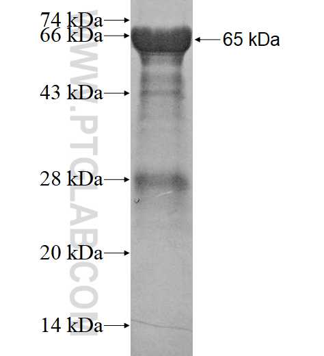 NCRNA00153 fusion protein Ag15454 SDS-PAGE