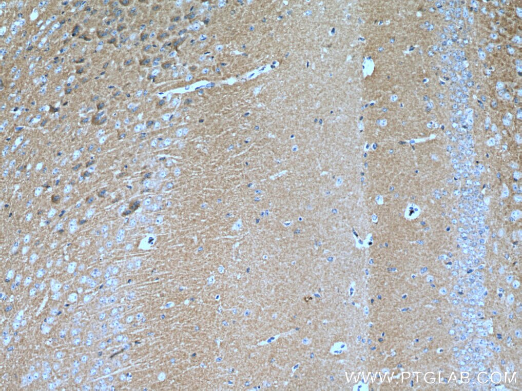 Immunohistochemistry (IHC) staining of mouse brain tissue using NCS1 Monoclonal antibody (67616-1-Ig)