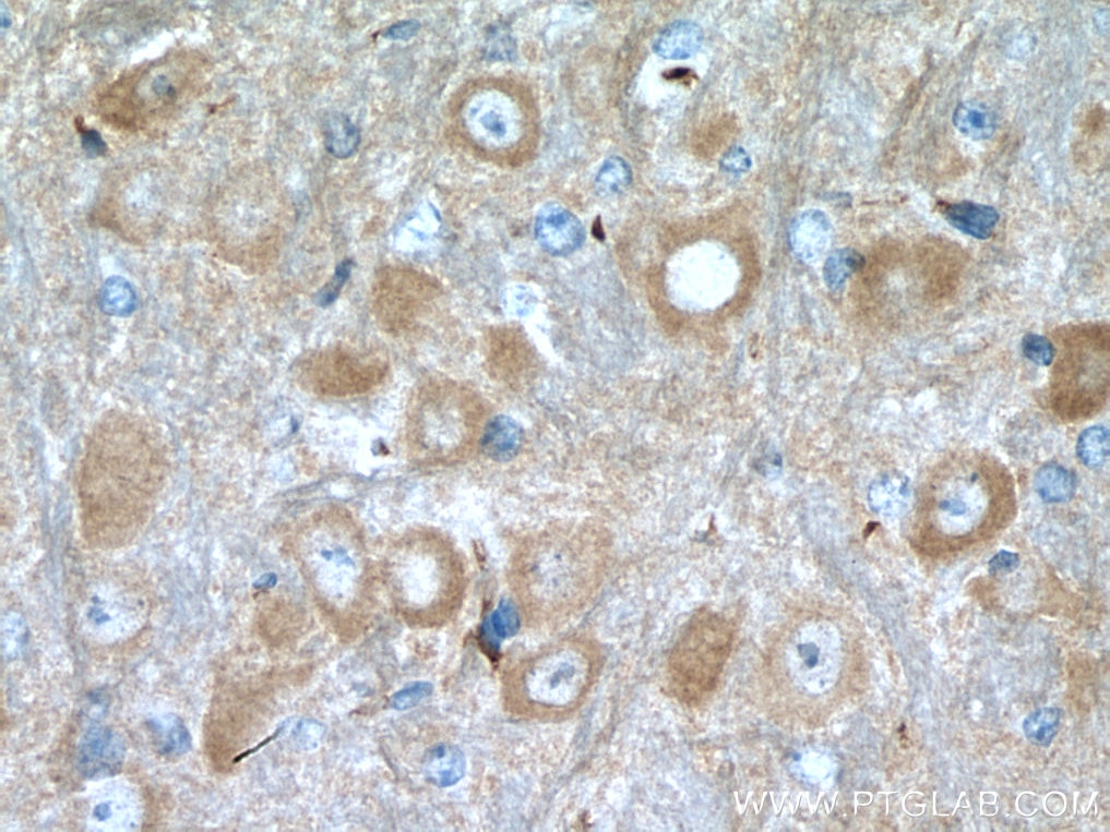 Immunohistochemistry (IHC) staining of mouse brain tissue using NCS1 Monoclonal antibody (67616-1-Ig)