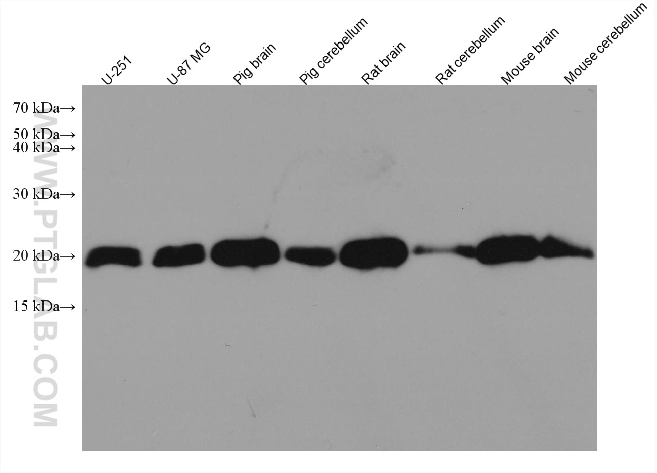 Western Blot (WB) analysis of various lysates using NCS1 Monoclonal antibody (67616-1-Ig)