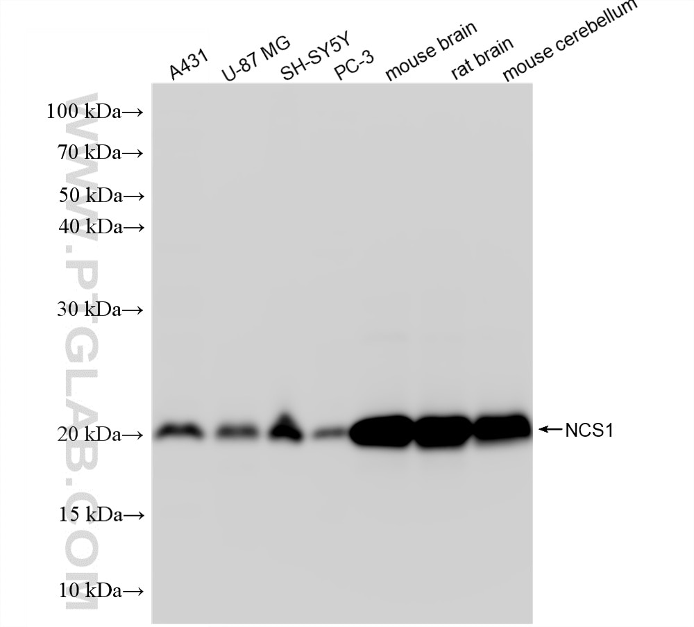 Western Blot (WB) analysis of various lysates using NCS1 Recombinant monoclonal antibody (87673-1-RR)