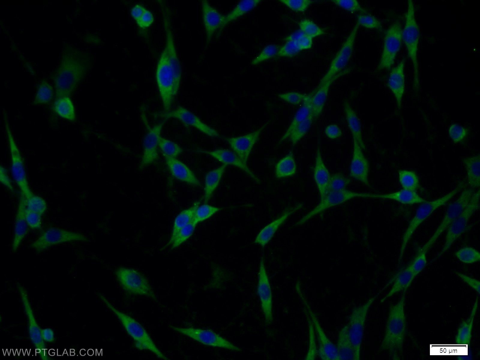 Immunofluorescence (IF) / fluorescent staining of C6 cells using Nicastrin Polyclonal antibody (14071-1-AP)