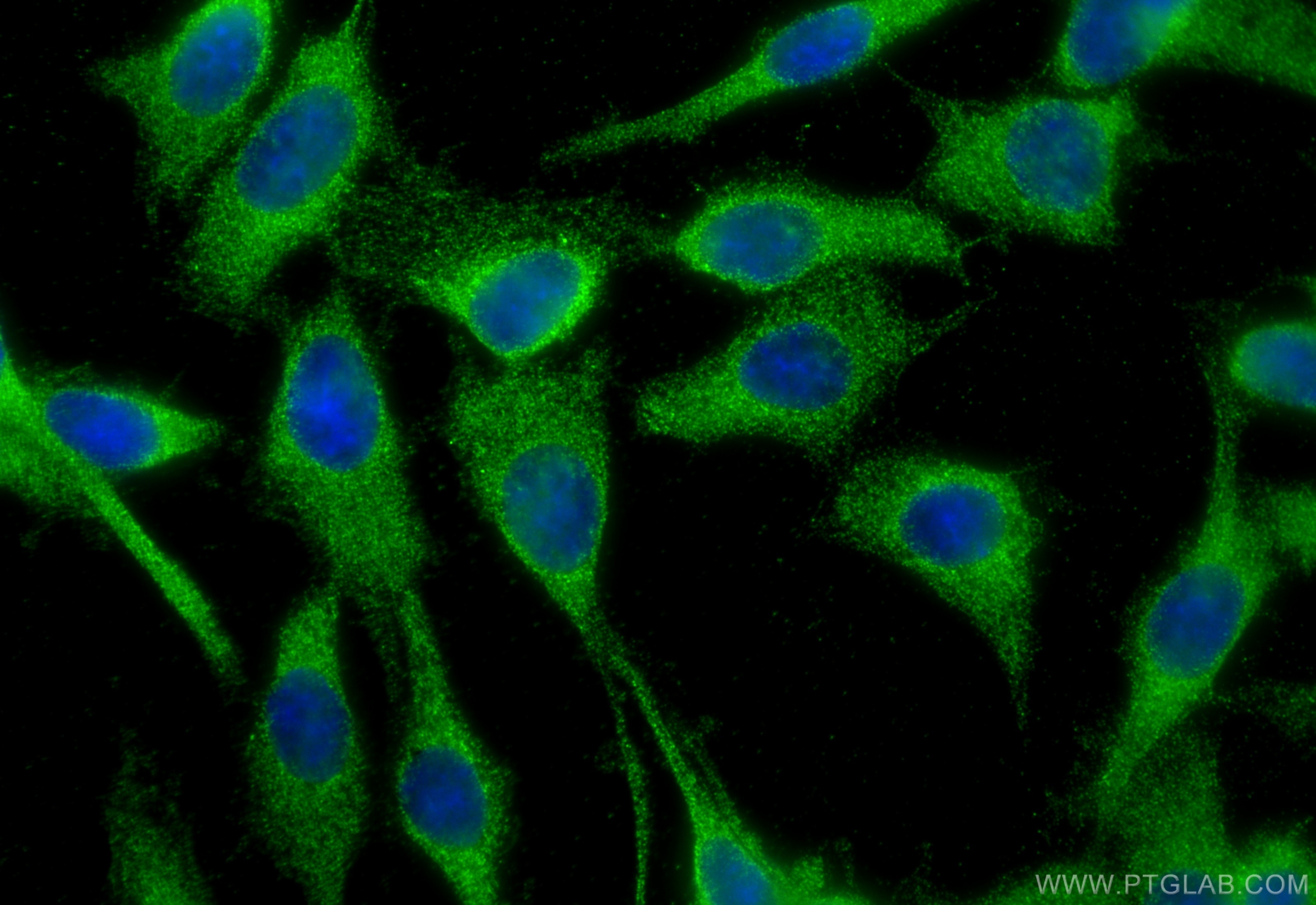 Immunofluorescence (IF) / fluorescent staining of C6 cells using Nicastrin Polyclonal antibody (14071-1-AP)