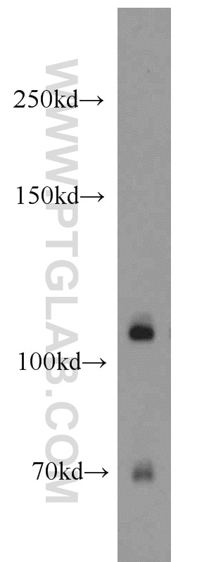 Western Blot (WB) analysis of mouse brain tissue using Nicastrin Polyclonal antibody (14071-1-AP)