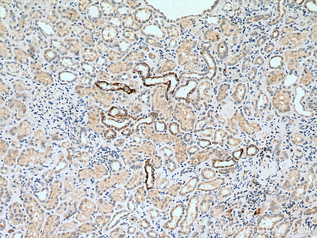 Immunohistochemistry (IHC) staining of human kidney tissue using NCX1 Polyclonal antibody (28447-1-AP)