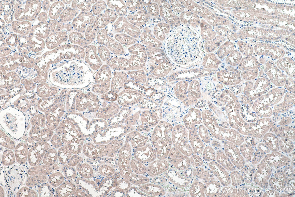 Immunohistochemistry (IHC) staining of human kidney tissue using NCX1 Polyclonal antibody (28447-1-AP)