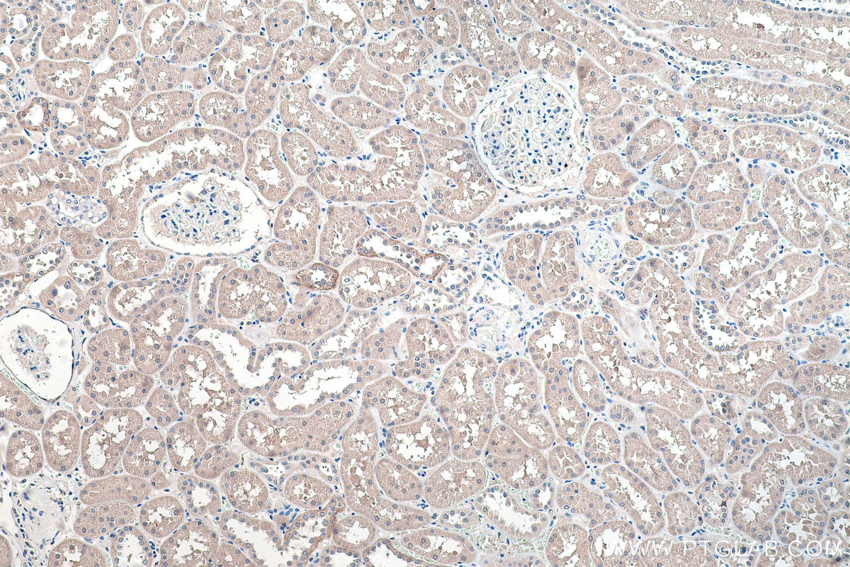 IHC staining of human kidney using 28447-1-AP