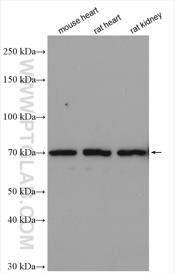 Western Blot (WB) analysis of various lysates using NCX1 Polyclonal antibody (28447-1-AP)