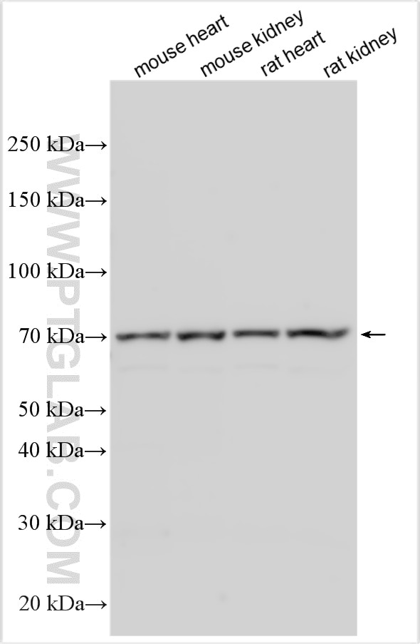 Western Blot (WB) analysis of various lysates using NCX1 Polyclonal antibody (28447-1-AP)