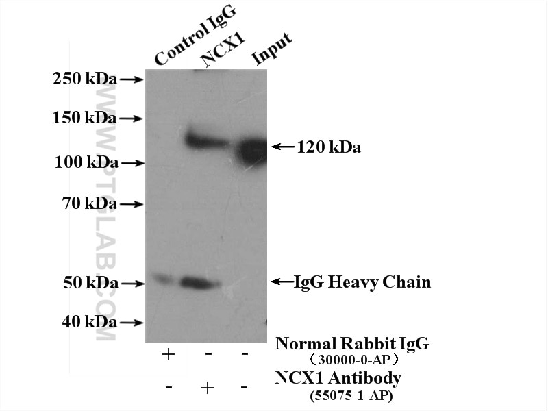 Immunoprecipitation (IP) experiment of mouse brain tissue using NCX1 Polyclonal antibody (55075-1-AP)
