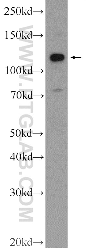 Western Blot (WB) analysis of rat brain tissue using NCX1 Polyclonal antibody (55075-1-AP)