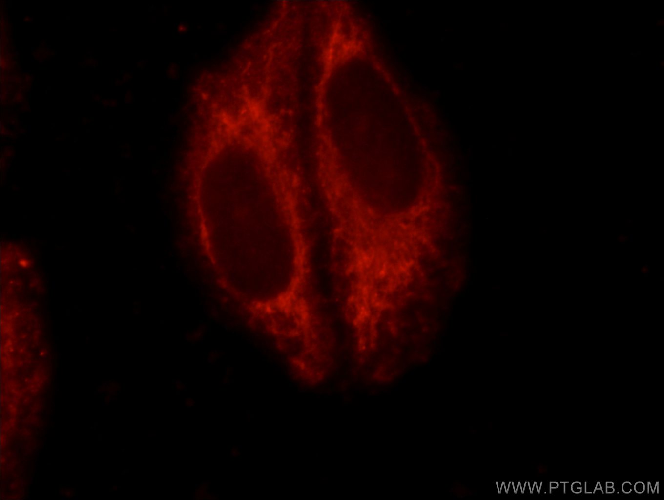 ND1 Polyclonal antibody