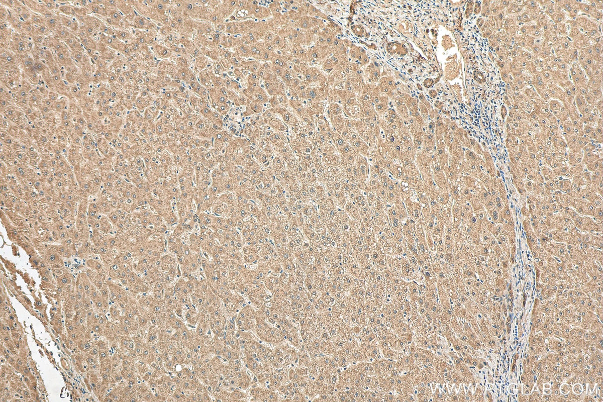 Immunohistochemistry (IHC) staining of human liver tissue using ND1 Polyclonal antibody (19703-1-AP)