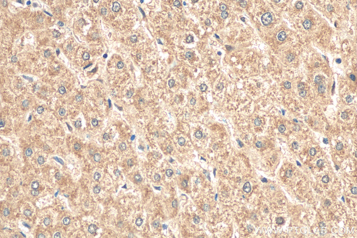 Immunohistochemistry (IHC) staining of human liver tissue using ND1 Polyclonal antibody (19703-1-AP)