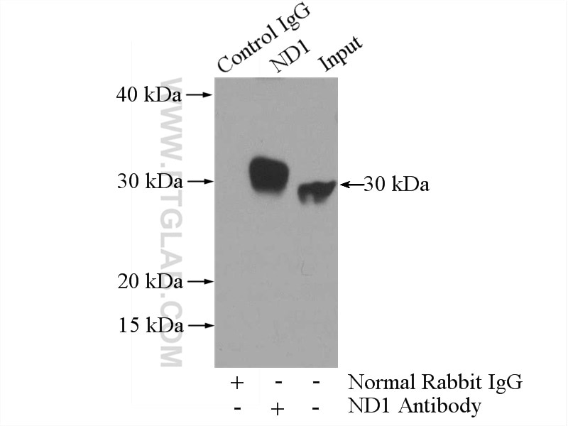 Immunoprecipitation (IP) experiment of mouse liver tissue using ND1 Polyclonal antibody (19703-1-AP)