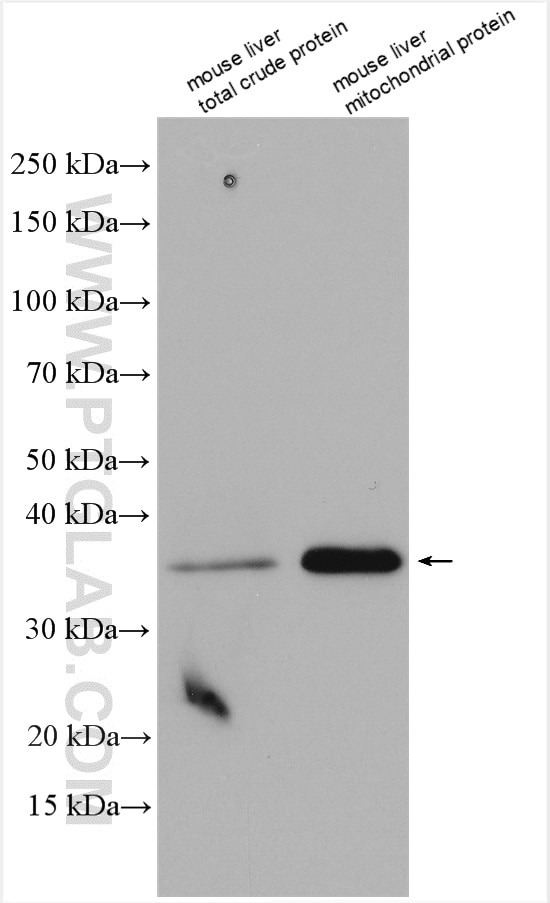 Western Blot (WB) analysis of various lysates using ND1 Polyclonal antibody (19703-1-AP)