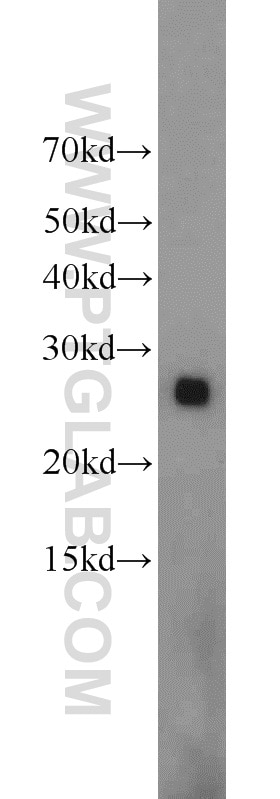 ND1 Polyclonal antibody