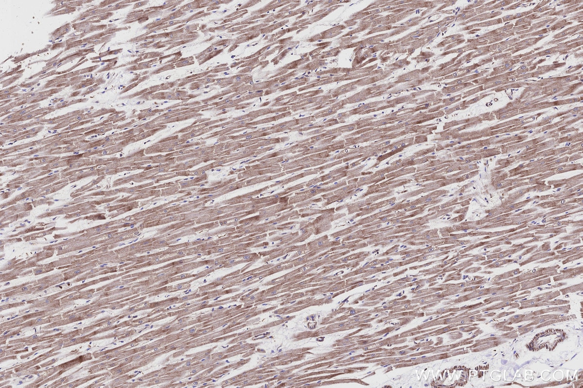 Immunohistochemistry (IHC) staining of human heart tissue using ND2 Polyclonal antibody (19704-1-AP)