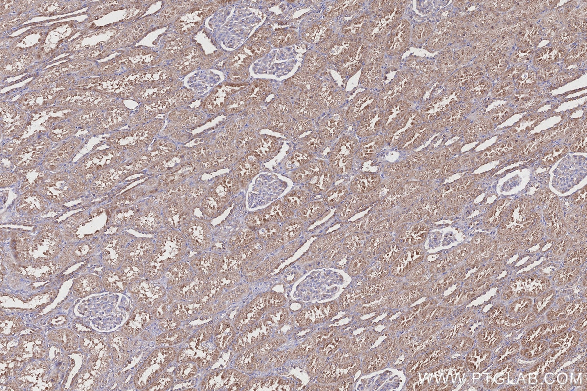 Immunohistochemistry (IHC) staining of human kidney tissue using ND2 Polyclonal antibody (19704-1-AP)
