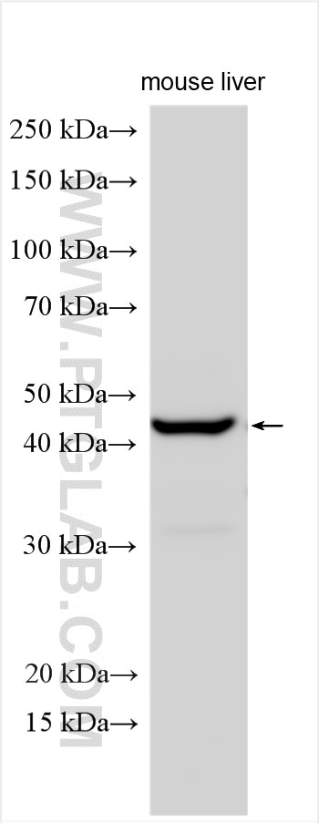 Western Blot (WB) analysis of various lysates using ND2 Polyclonal antibody (19704-1-AP)