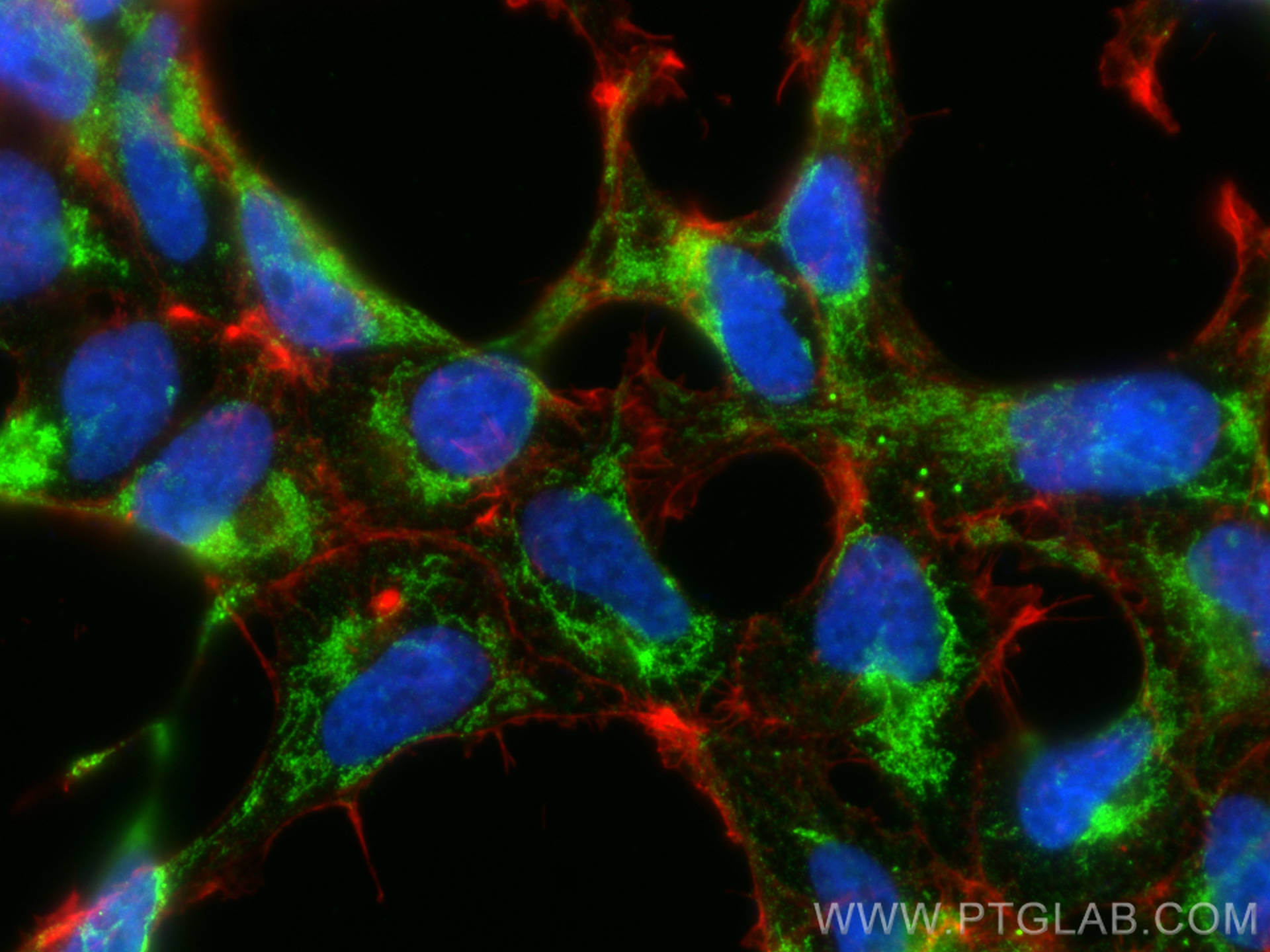 Immunofluorescence (IF) / fluorescent staining of HEK-293 cells using ND3 Polyclonal antibody (29341-1-AP)