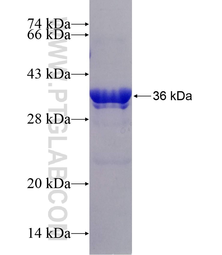 ND3 fusion protein Ag29115 SDS-PAGE
