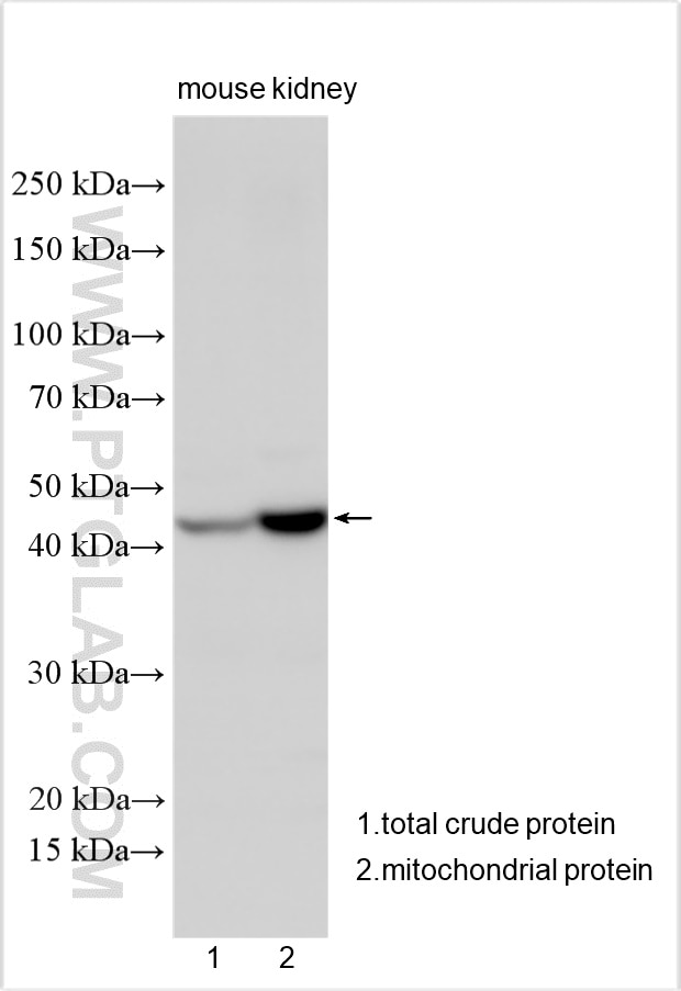 Western Blot (WB) analysis of various lysates using ND4 Polyclonal antibody (26736-1-AP)