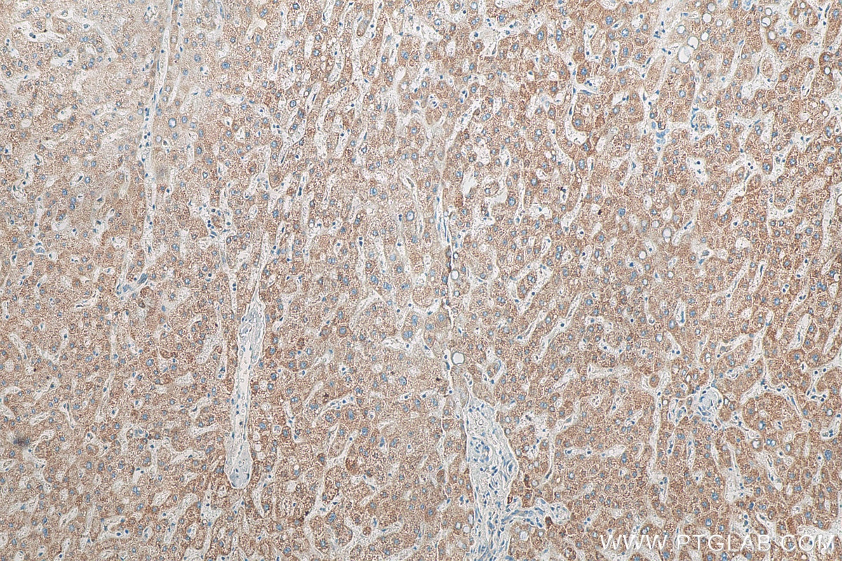 Immunohistochemistry (IHC) staining of human liver tissue using ND5 Polyclonal antibody (55410-1-AP)