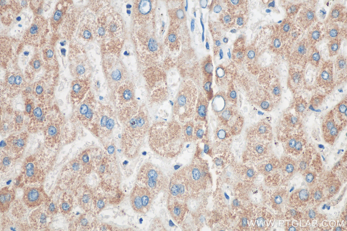 Immunohistochemistry (IHC) staining of human liver tissue using ND5 Polyclonal antibody (55410-1-AP)
