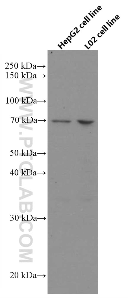 ND5 Fusion Protein Ag34530 | Proteintech