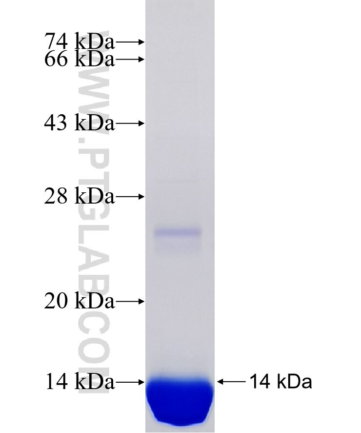 ND5 fusion protein Ag34530 SDS-PAGE ND5 fusion protein Ag34530 SDS-PAGE