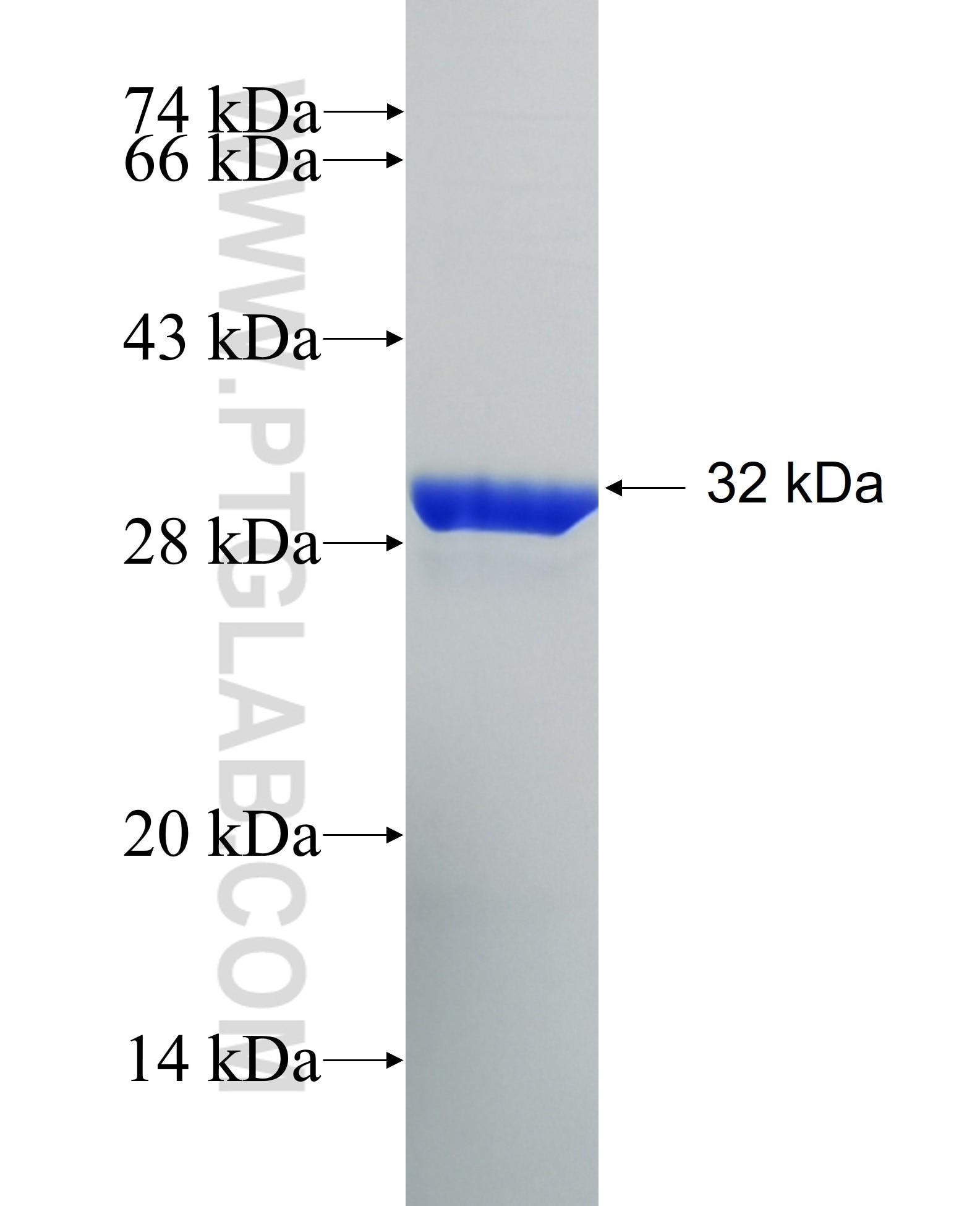 ND6 fusion protein Ag34496 SDS-PAGE