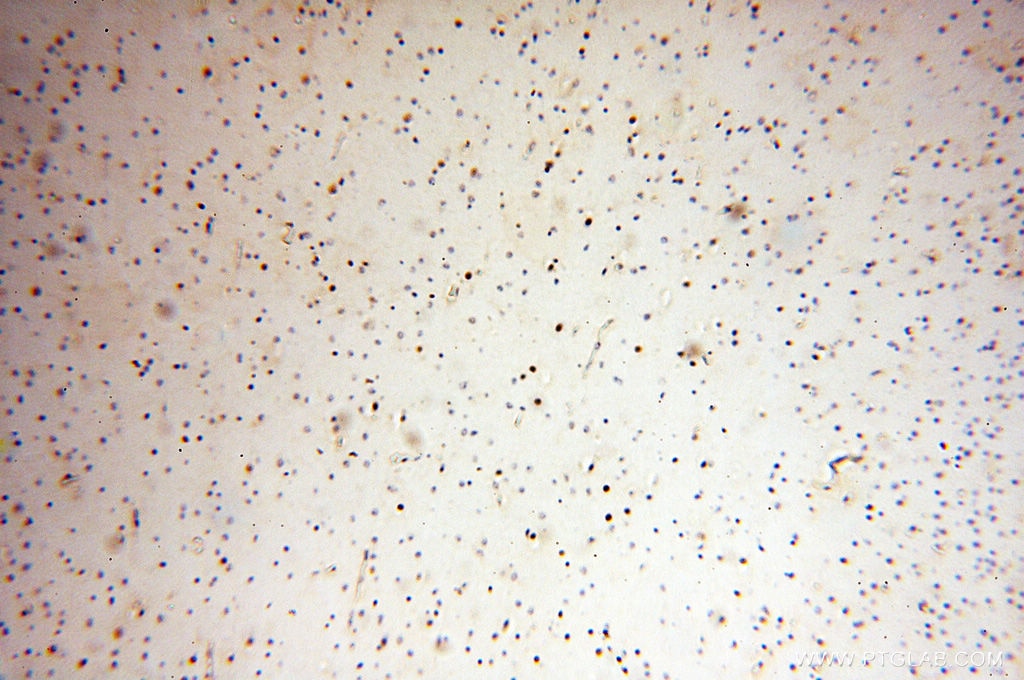 Immunohistochemistry (IHC) staining of human brain tissue using NDC80 Polyclonal antibody (18932-1-AP)
