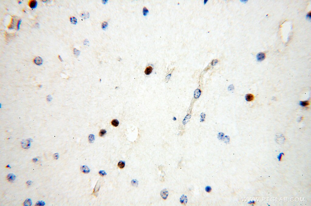 Immunohistochemistry (IHC) staining of human brain tissue using NDC80 Polyclonal antibody (18932-1-AP)