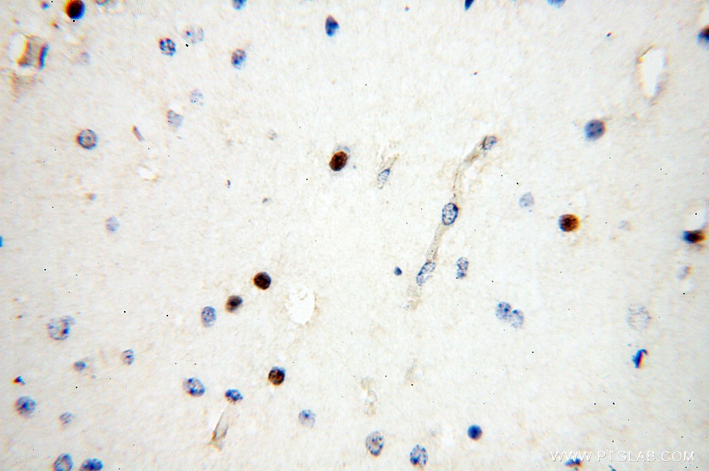 Immunohistochemistry (IHC) staining of human brain tissue using NDC80 Polyclonal antibody (18932-1-AP)