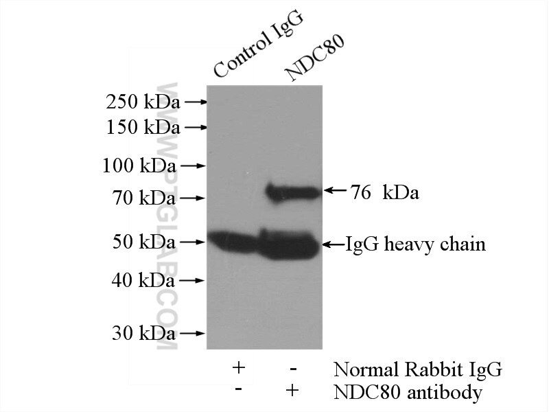 Immunoprecipitation (IP) experiment of A2780 cells using NDC80 Polyclonal antibody (18932-1-AP)