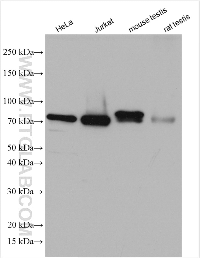 Western Blot (WB) analysis of various lysates using NDC80 Polyclonal antibody (18932-1-AP)