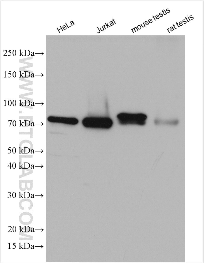 Western Blot (WB) analysis of various lysates using NDC80 Polyclonal antibody (18932-1-AP)