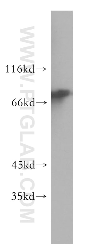 Western Blot (WB) analysis of A2780 cells using NDC80 Polyclonal antibody (18932-1-AP)