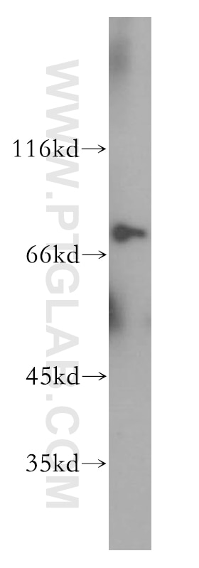 Western Blot (WB) analysis of human spleen tissue using NDC80 Polyclonal antibody (18932-1-AP)