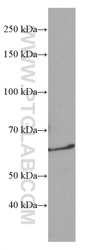 Western Blot (WB) analysis of HSC-T6 cells using NDC80 Monoclonal antibody (66960-1-Ig)