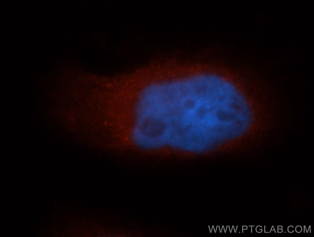 Immunofluorescence (IF) / fluorescent staining of MCF-7 cells using NDE1 Polyclonal antibody (10233-1-AP)