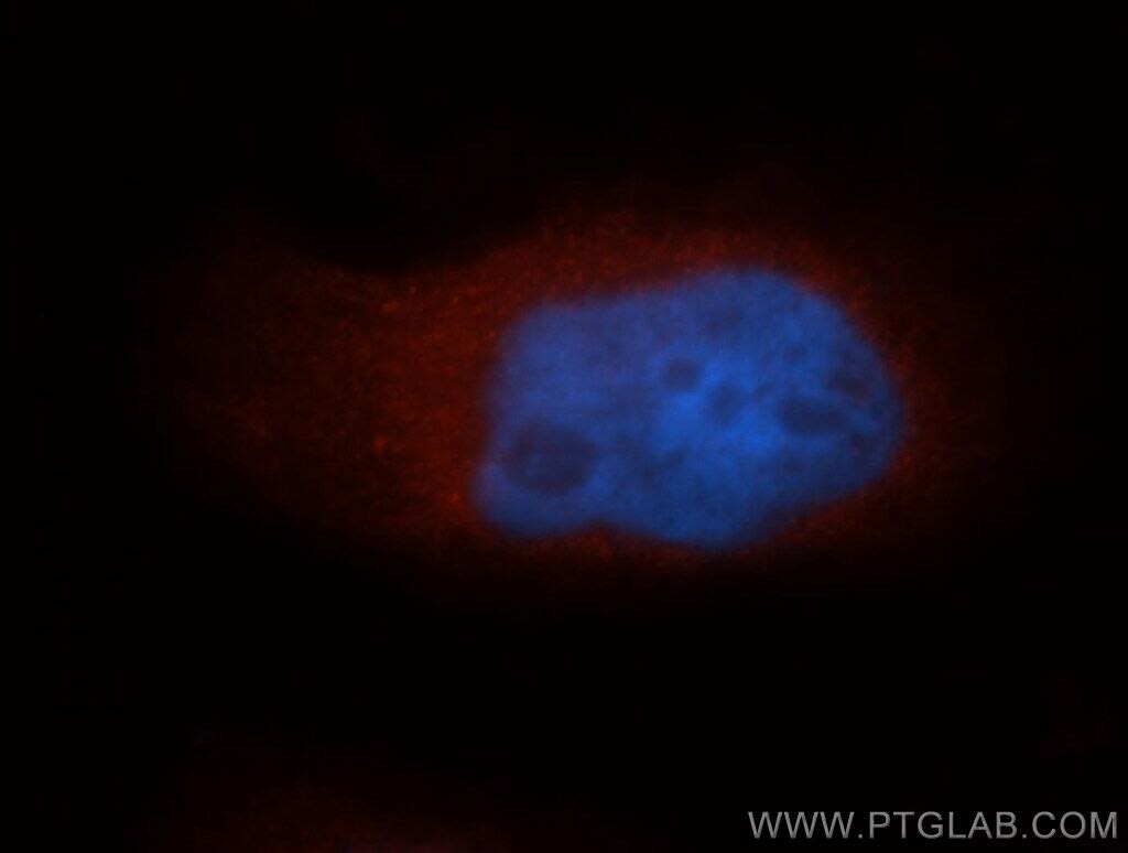 IF Staining of MCF-7 using 10233-1-AP