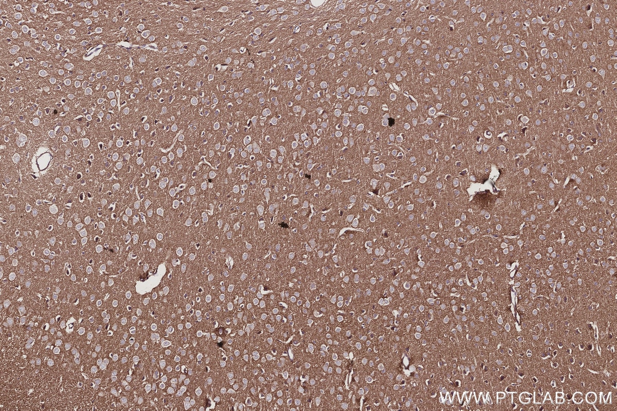 Immunohistochemistry (IHC) staining of mouse brain tissue using NDE1 Polyclonal antibody (10233-1-AP)