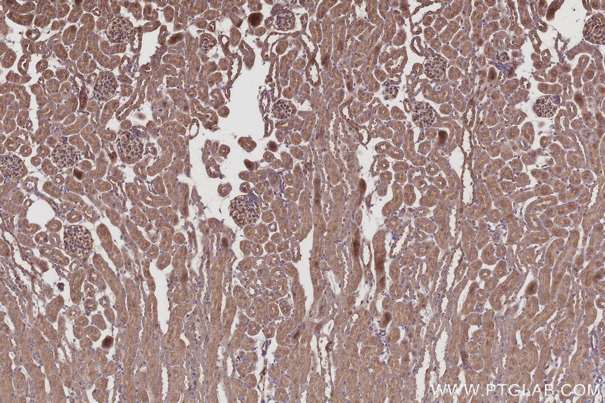 Immunohistochemistry (IHC) staining of mouse kidney tissue using NDE1 Polyclonal antibody (10233-1-AP)