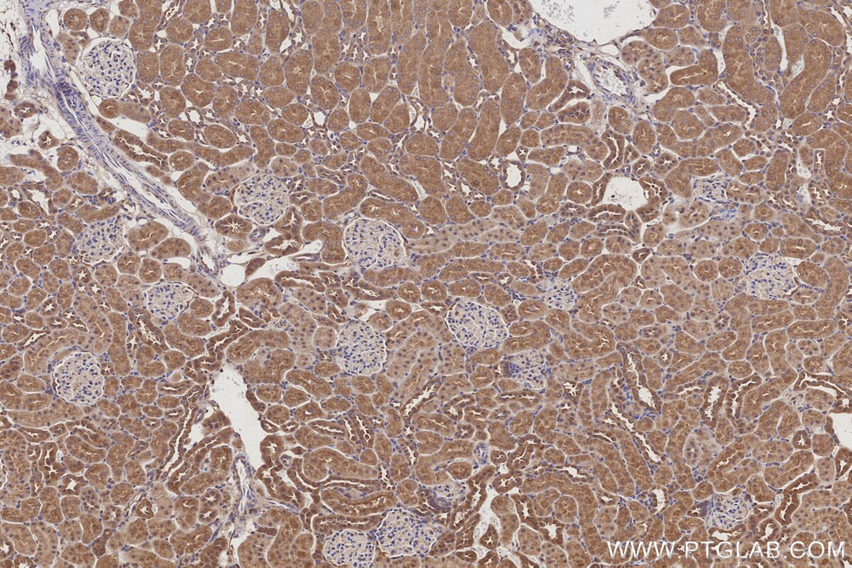Immunohistochemistry (IHC) staining of rat kidney tissue using NDE1 Polyclonal antibody (10233-1-AP)