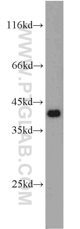 Western Blot (WB) analysis of A2780 cells using NDE1 Polyclonal antibody (10233-1-AP)