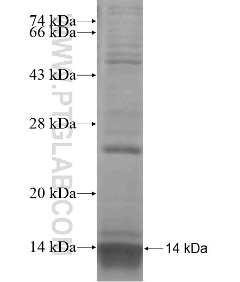 NDE1 fusion protein Ag19175 SDS-PAGE