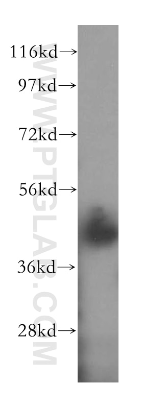 NDEL1 Polyclonal antibody