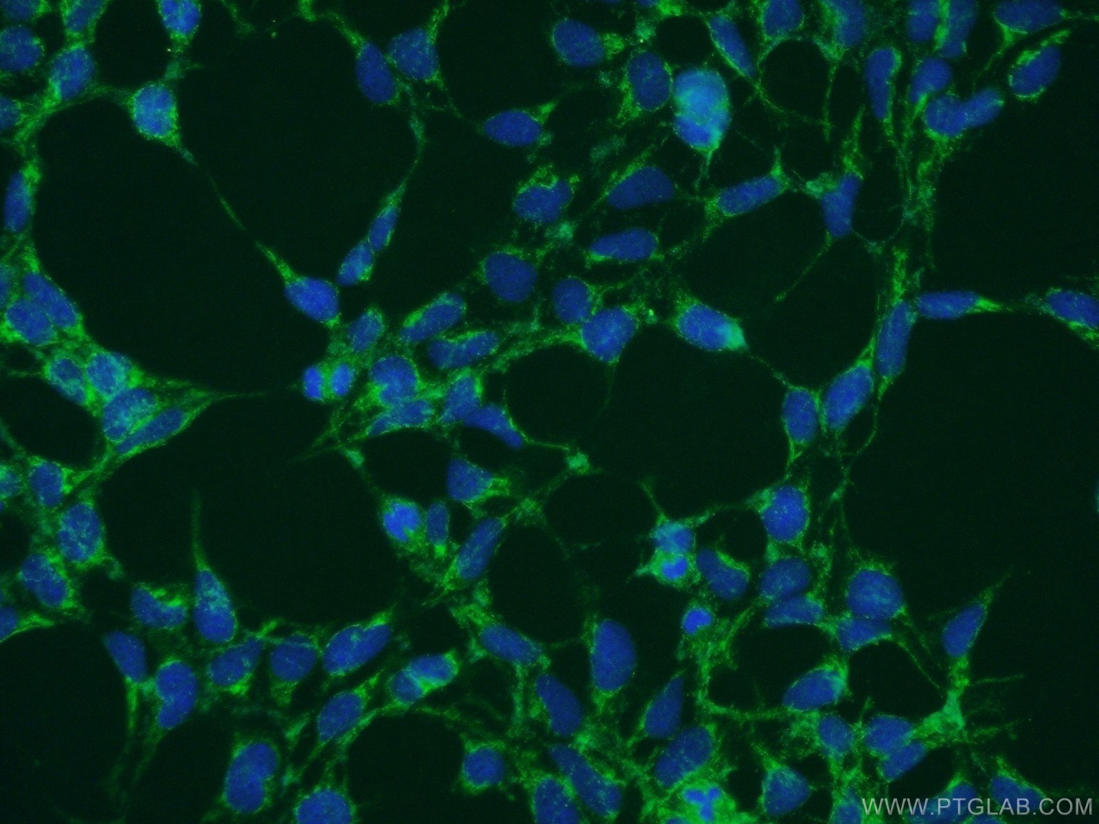 Immunofluorescence (IF) / fluorescent staining of HEK-293 cells using NDFIP1 Polyclonal antibody (15602-1-AP)